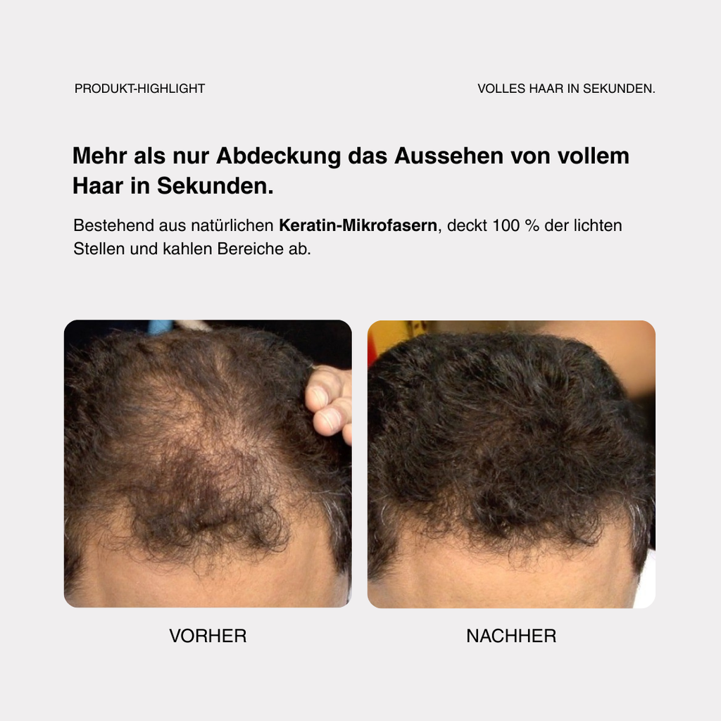 Skylive - Full Hair Pro