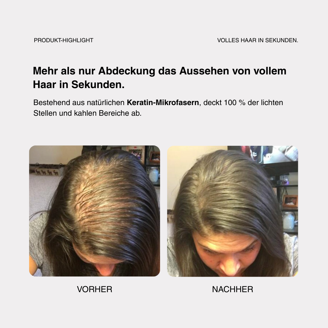Skylive - Full Hair Pro