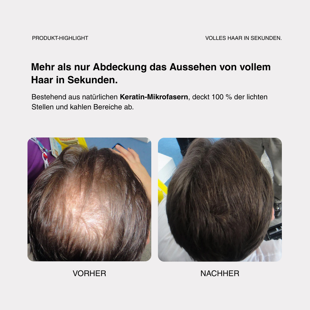 Skylive - Full Hair Pro