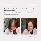 Skylive Full Hair Pro