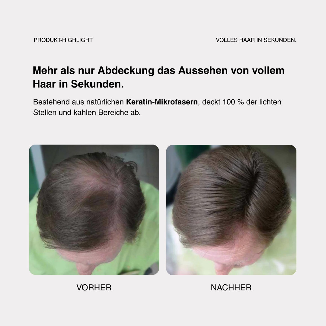 Skylive - Full Hair Pro