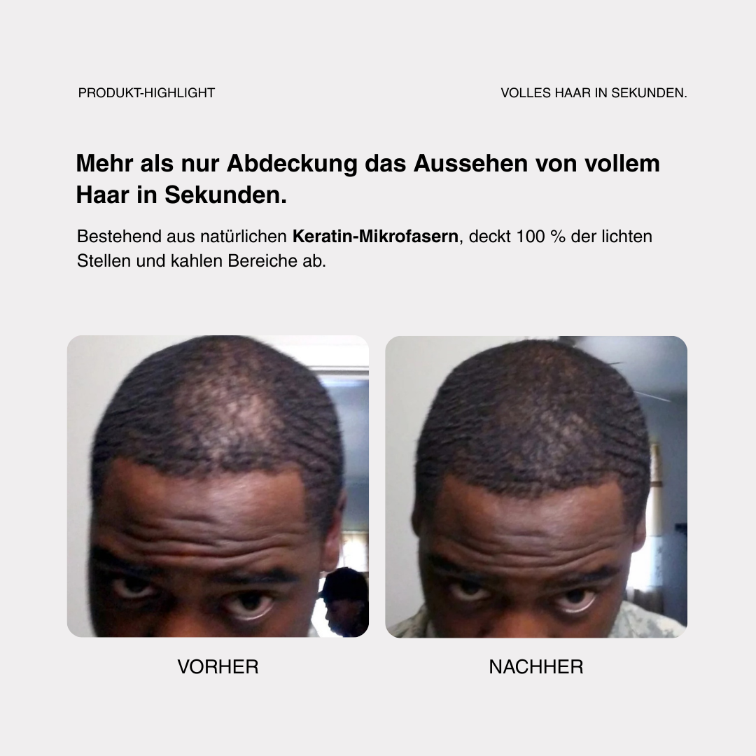Skylive - Full Hair Pro