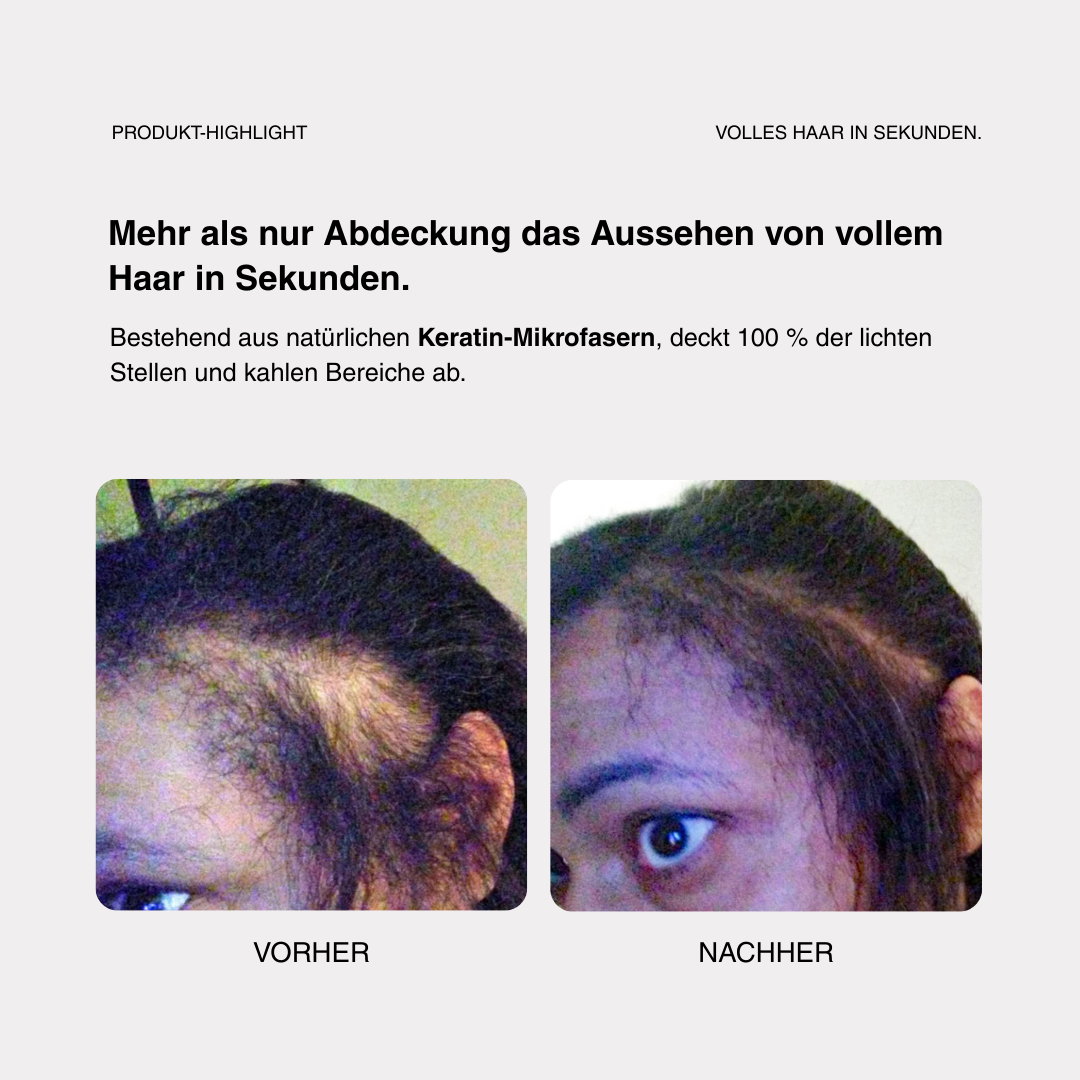 Skylive - Full Hair Pro